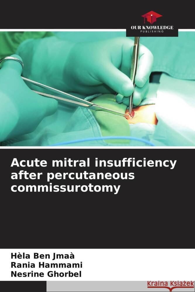 Acute mitral insufficiency after percutaneous commissurotomy Ben Jmaà, Hèla, HAMMAMI, Rania, Ghorbel, Nesrine 9786208253431 Our Knowledge Publishing