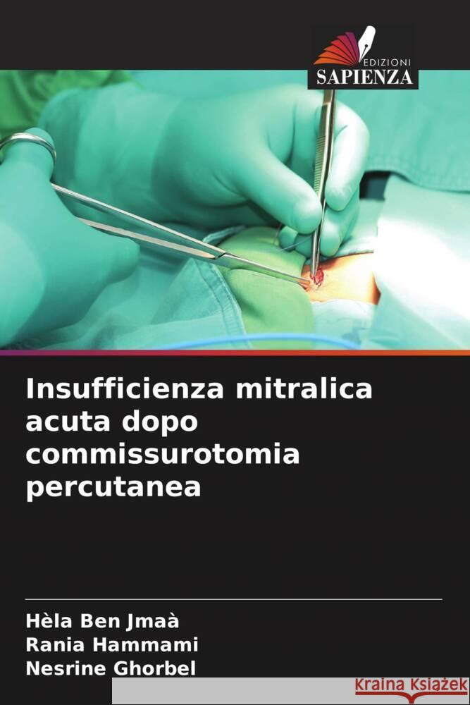 Insufficienza mitralica acuta dopo commissurotomia percutanea Ben Jmaà, Hèla, HAMMAMI, Rania, Ghorbel, Nesrine 9786208253493 Edizioni Sapienza