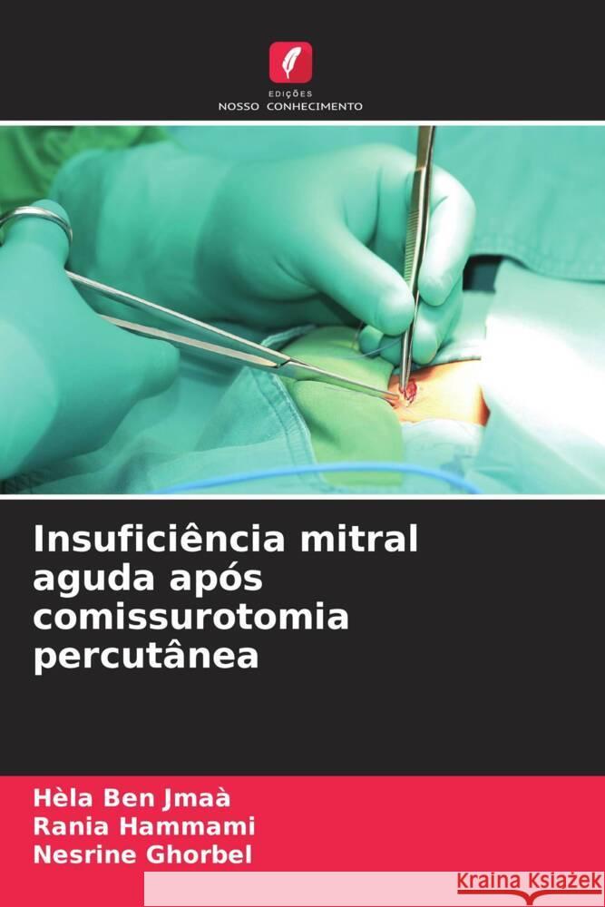 Insuficiência mitral aguda após comissurotomia percutânea Ben Jmaà, Hèla, HAMMAMI, Rania, Ghorbel, Nesrine 9786208253516 Edições Nosso Conhecimento