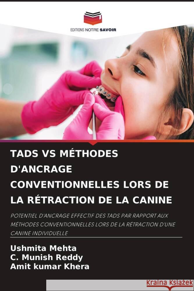 TADS VS MÉTHODES D'ANCRAGE CONVENTIONNELLES LORS DE LA RÉTRACTION DE LA CANINE Mehta, Ushmita, Reddy, C. Munish, Khera, Amit Kumar 9786208254711