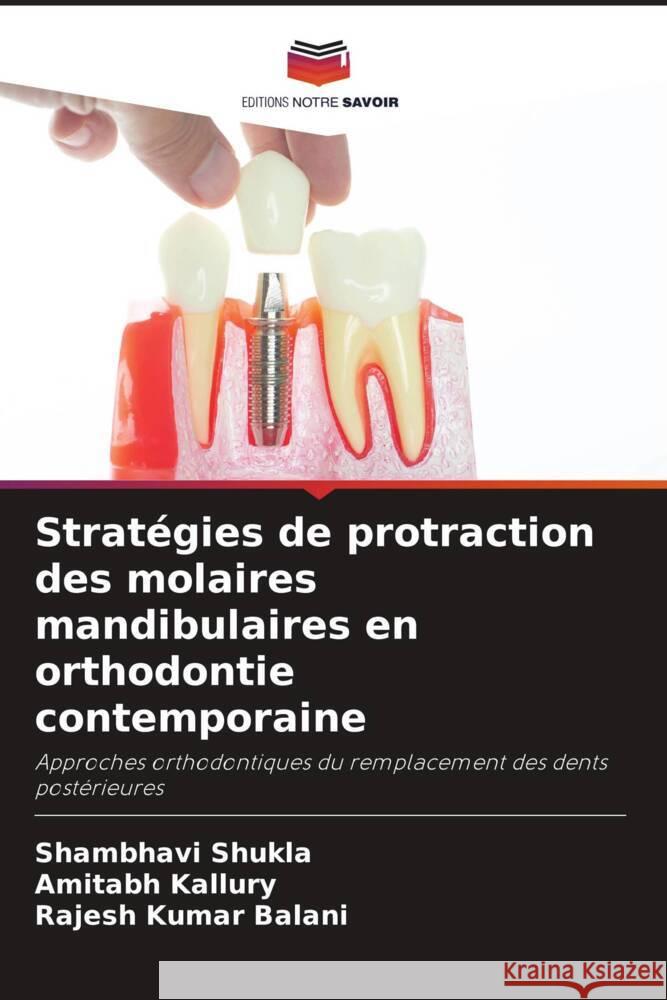 Stratégies de protraction des molaires mandibulaires en orthodontie contemporaine Shukla, Shambhavi, Kallury, Amitabh, Kumar Balani, Rajesh 9786208254933