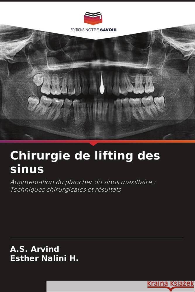 Chirurgie de lifting des sinus Arvind, A.S., Nalini H., Esther 9786208268190