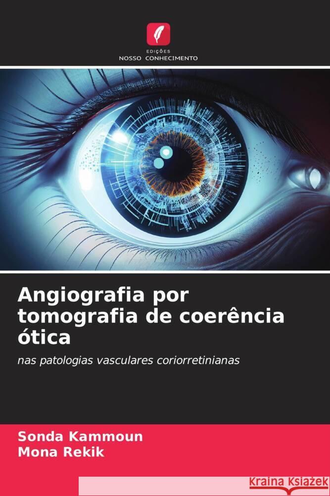 Angiografia por tomografia de coer?ncia ?tica Sonda Kammoun Mona Rekik 9786208276041