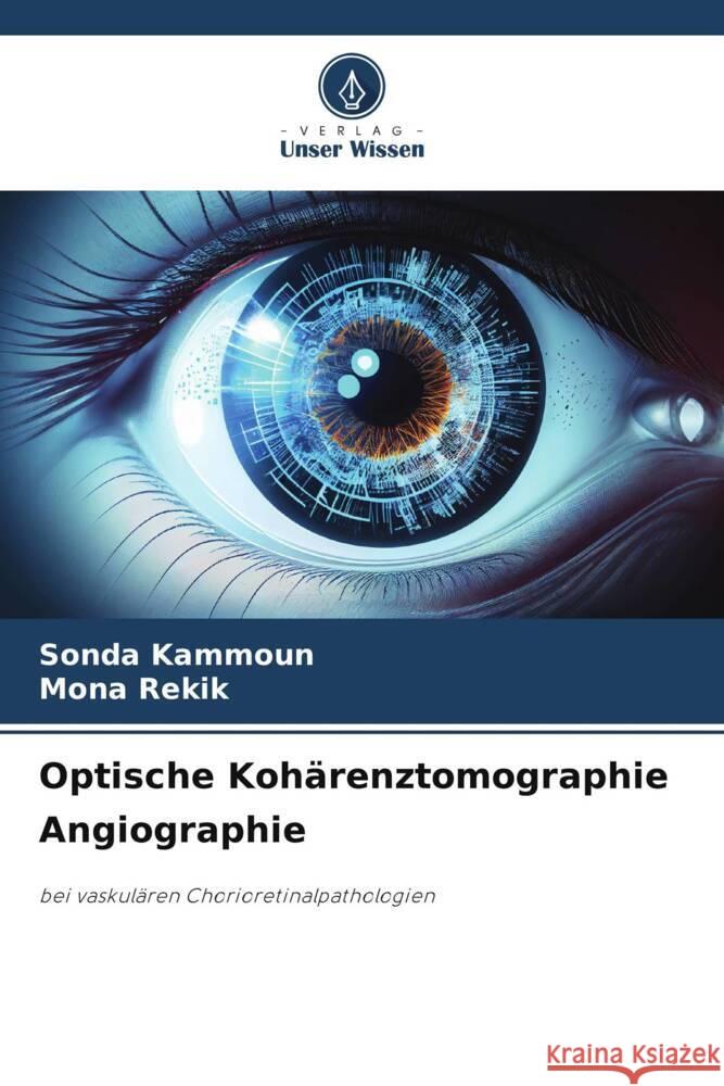 Optische Koh?renztomographie Angiographie Sonda Kammoun Mona Rekik 9786208276065