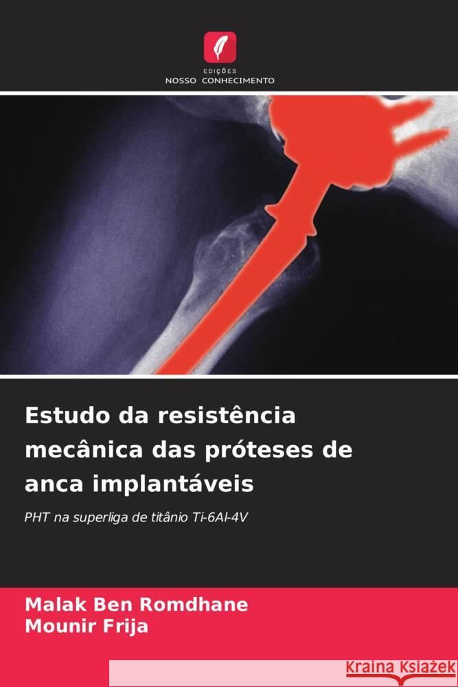 Estudo da resistência mecânica das próteses de anca implantáveis Ben Romdhane, Malak, Frija, Mounir 9786208285470