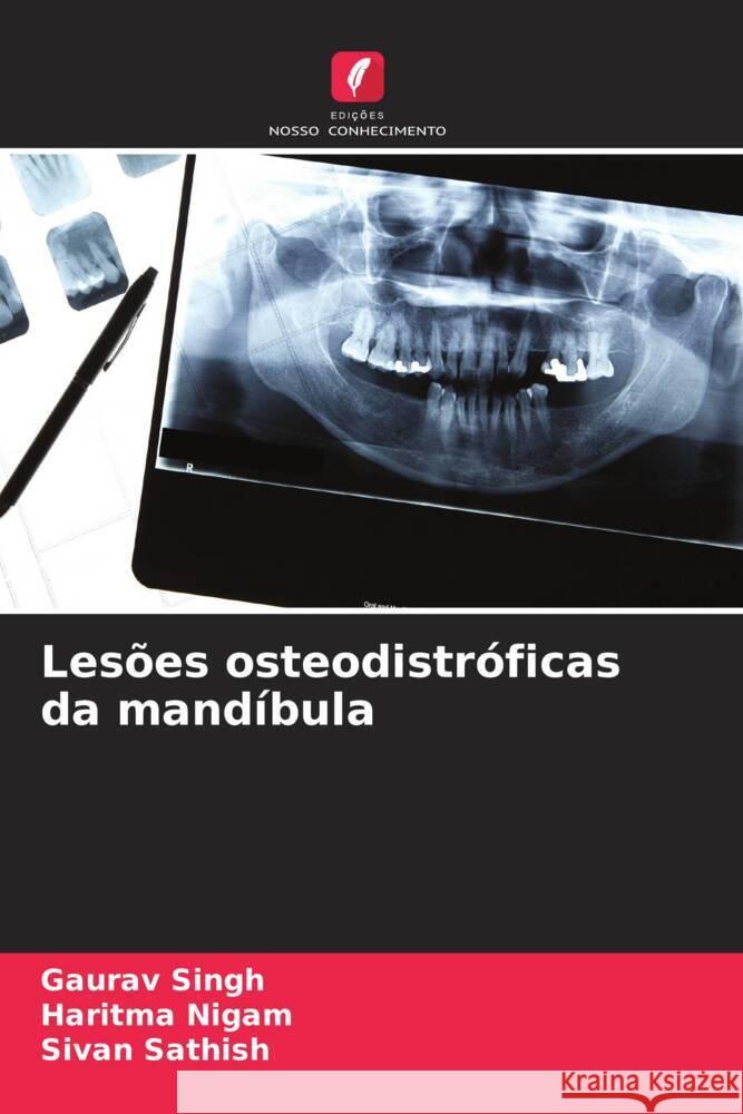 Les?es osteodistr?ficas da mand?bula Gaurav Singh Haritma Nigam Sivan Sathish 9786208285739 Edicoes Nosso Conhecimento