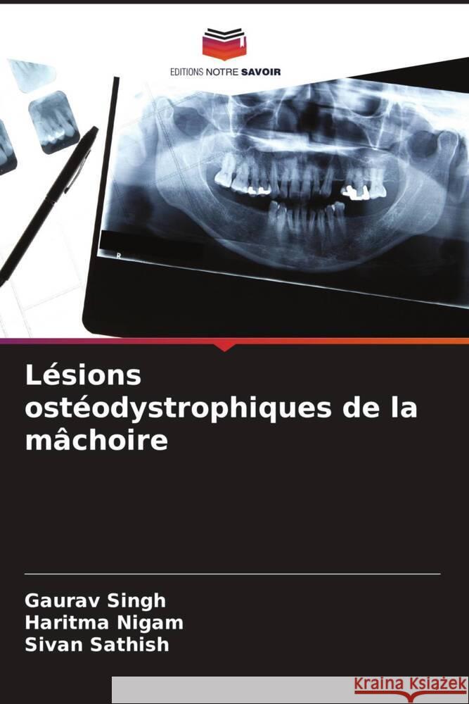 Lésions ostéodystrophiques de la mâchoire Singh, Gaurav, Nigam, Haritma, SATHISH, SIVAN 9786208285760