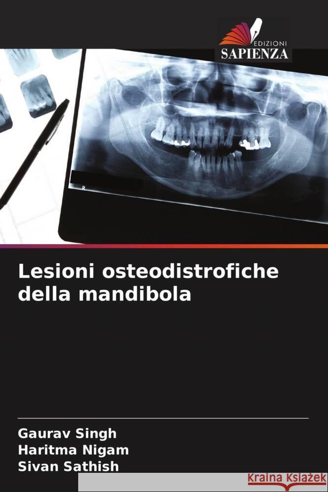 Lesioni osteodistrofiche della mandibola Singh, Gaurav, Nigam, Haritma, SATHISH, SIVAN 9786208285777