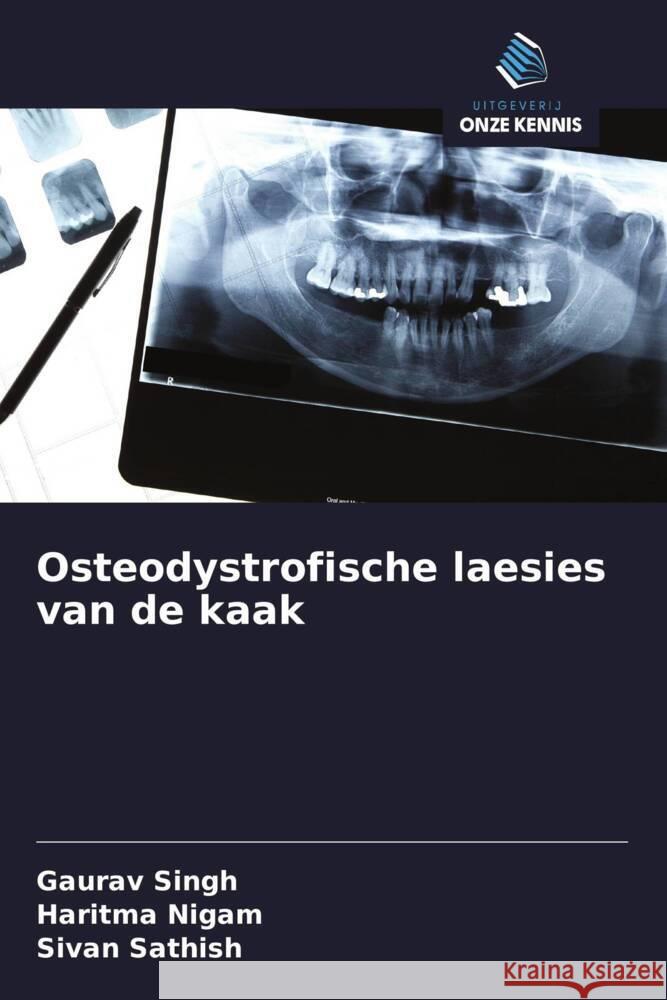 Osteodystrofische laesies van de kaak Singh, Gaurav, Nigam, Haritma, SATHISH, SIVAN 9786208285784