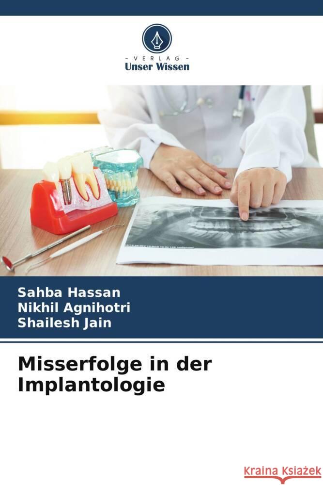 Misserfolge in der Implantologie Hassan, Sahba, Agnihotri, Nikhil, Jain, Shailesh 9786208285975