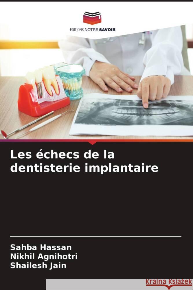 Les échecs de la dentisterie implantaire Hassan, Sahba, Agnihotri, Nikhil, Jain, Shailesh 9786208286002