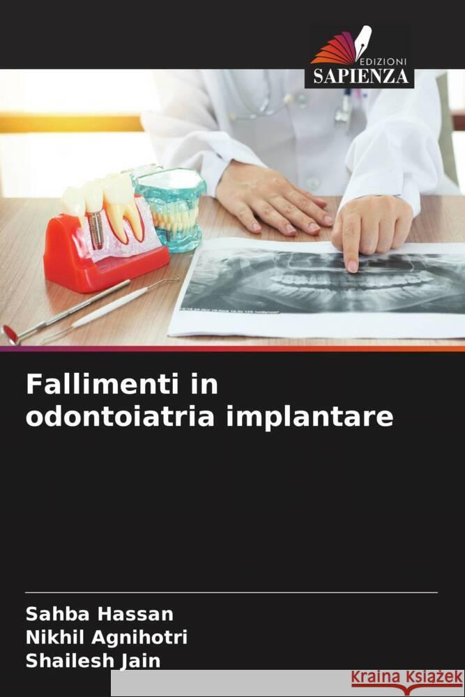 Fallimenti in odontoiatria implantare Hassan, Sahba, Agnihotri, Nikhil, Jain, Shailesh 9786208286019