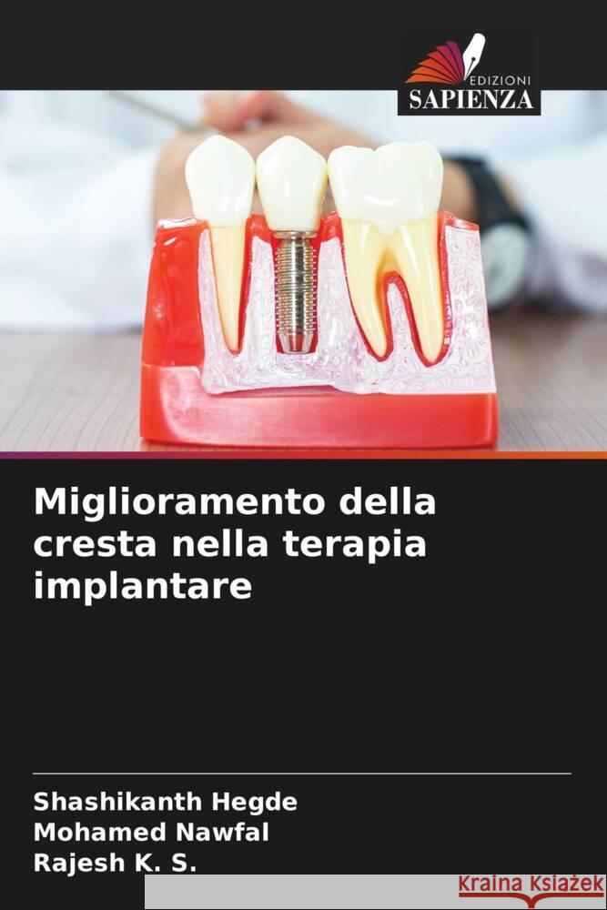 Miglioramento della cresta nella terapia implantare Hegde, Shashikanth, NAWFAL, MOHAMED, K. S., Rajesh 9786208292973