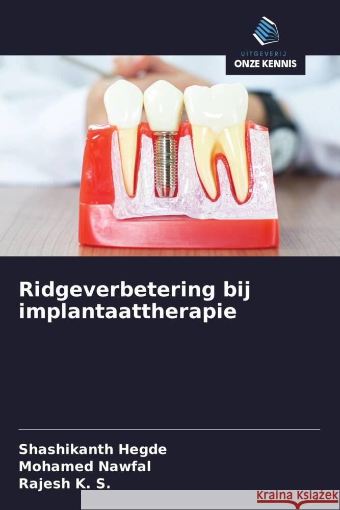 Ridgeverbetering bij implantaattherapie Hegde, Shashikanth, NAWFAL, MOHAMED, K. S., Rajesh 9786208292980