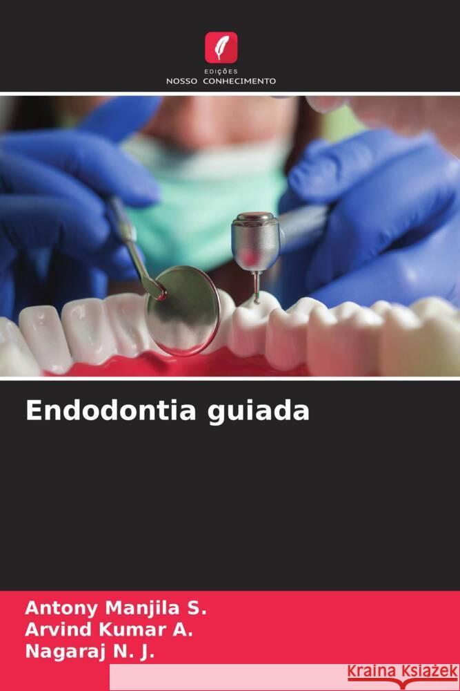 Endodontia guiada Manjila S., Antony, A., Arvind Kumar, N. J., Nagaraj 9786208294823 Edições Nosso Conhecimento