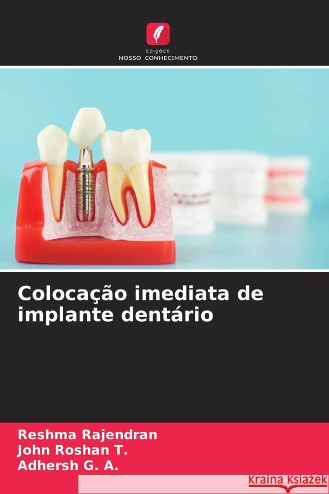 Colocação imediata de implante dentário Rajendran, Reshma, Roshan  T., John, G. A., Adhersh 9786208299781 Edições Nosso Conhecimento