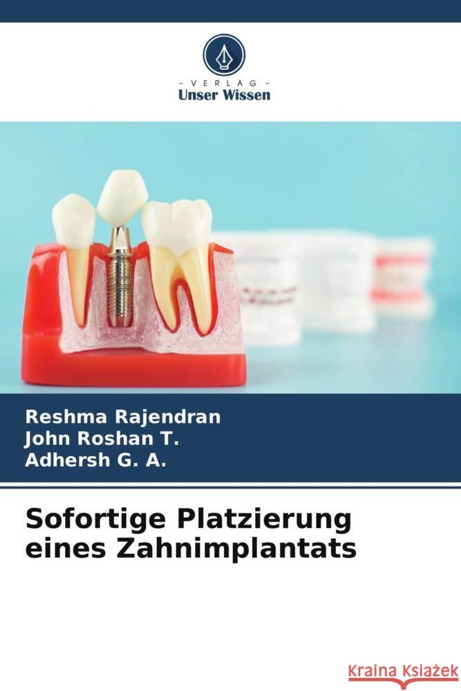 Sofortige Platzierung eines Zahnimplantats Rajendran, Reshma, Roshan  T., John, G. A., Adhersh 9786208299804