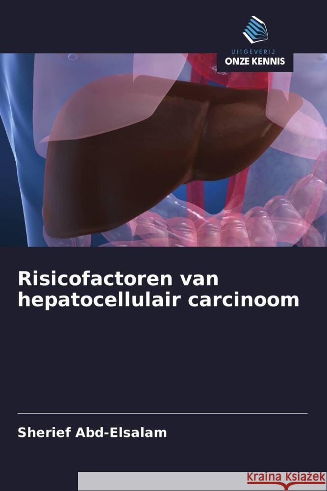 Risicofactoren van hepatocellulair carcinoom Abd-Elsalam, Sherief 9786208318659 Uitgeverij Onze Kennis
