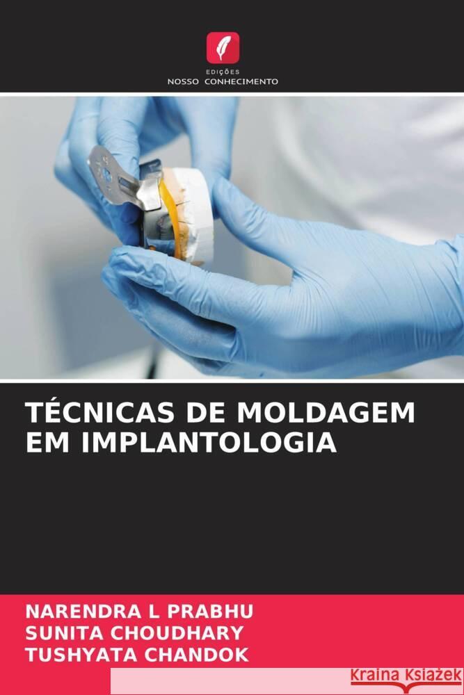 T?cnicas de Moldagem Em Implantologia Narendra L. Prabhu Sunita Choudhary Tushyata Chandok 9786208326494