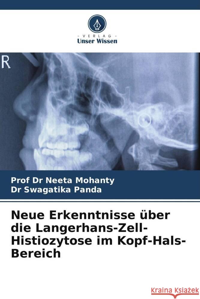 Neue Erkenntnisse über die Langerhans-Zell-Histiozytose im Kopf-Hals-Bereich Mohanty, Prof Dr Neeta, Panda, Dr Swagatika 9786208326968