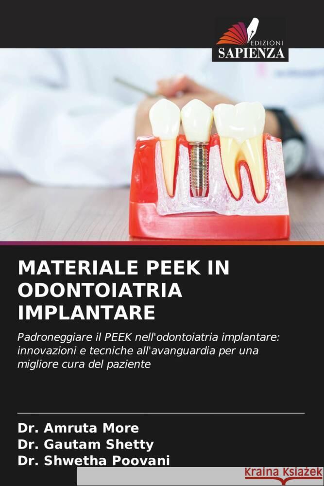 Materiale Peek in Odontoiatria Implantare Amruta More Gautam Shetty Shwetha Poovani 9786208329310