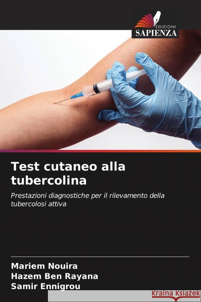 Test cutaneo alla tubercolina Nouira, Mariem, Ben Rayana, Hazem, Ennigrou, Samir 9786208329679 Edizioni Sapienza