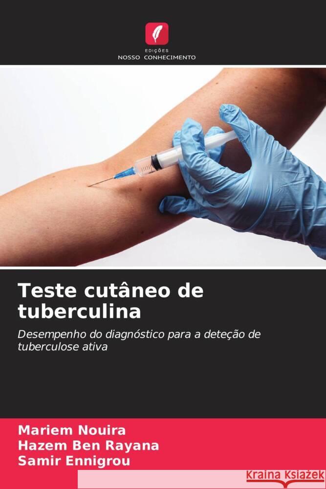 Teste cutâneo de tuberculina Nouira, Mariem, Ben Rayana, Hazem, Ennigrou, Samir 9786208329709 Edições Nosso Conhecimento