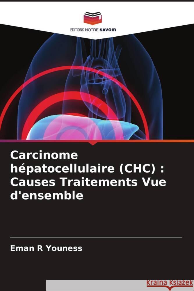 Carcinome hépatocellulaire (CHC) : Causes Traitements Vue d'ensemble Youness, Eman R 9786208341138