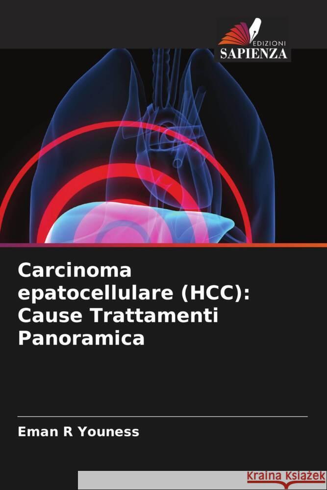 Carcinoma epatocellulare (HCC): Cause Trattamenti Panoramica Youness, Eman R 9786208341145