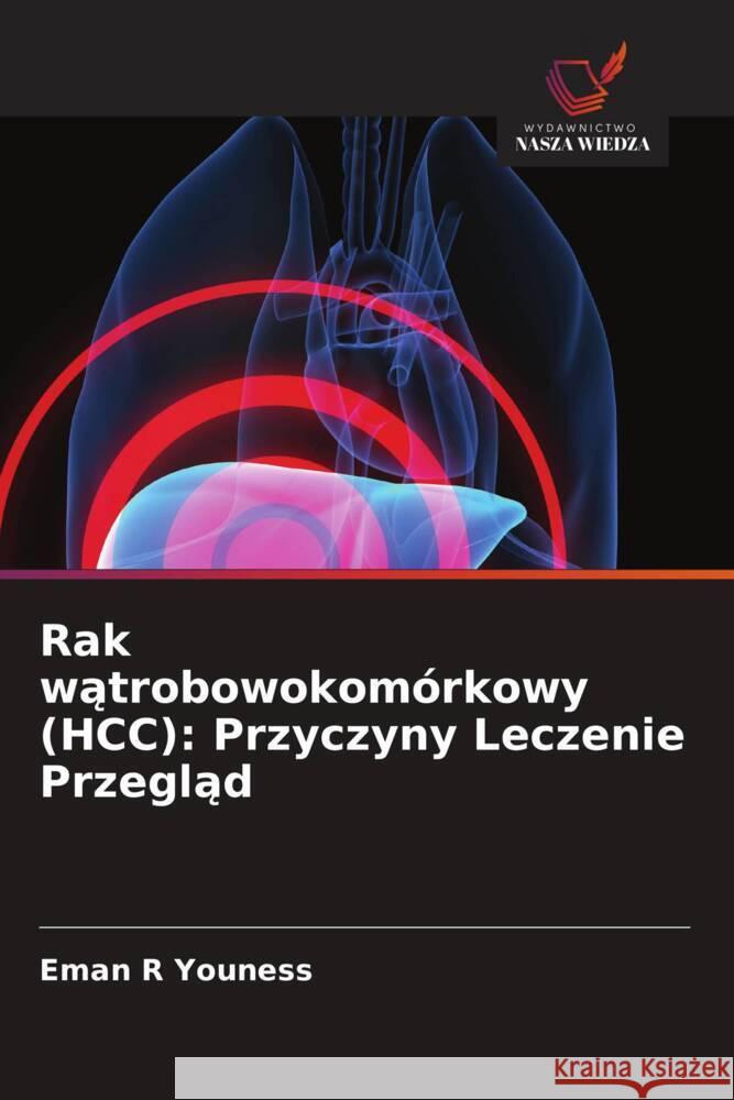 Rak watrobowokomórkowy (HCC): Przyczyny Leczenie Przeglad Youness, Eman R 9786208341152