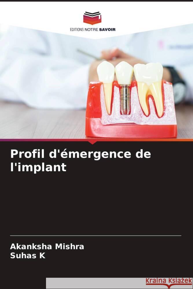 Profil d'émergence de l'implant Mishra, Akanksha, K, Suhas 9786208343705