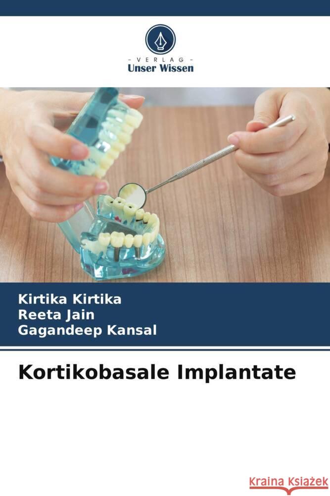 Kortikobasale Implantate Kirtika, Kirtika, Jain, Reeta, Kansal, Gagandeep 9786208347635