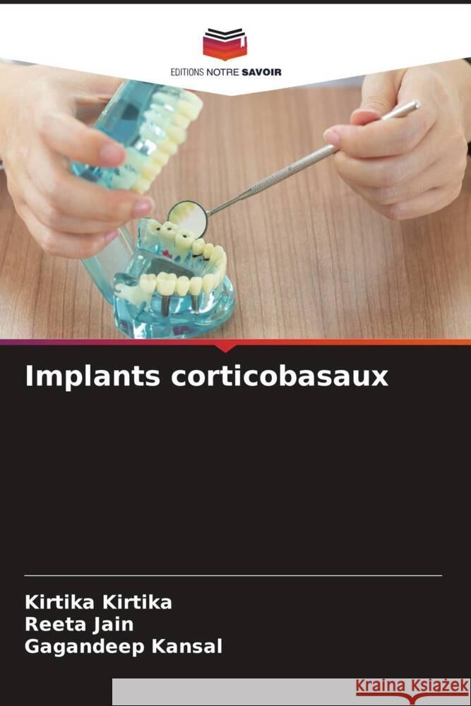 Implants corticobasaux Kirtika, Kirtika, Jain, Reeta, Kansal, Gagandeep 9786208347659