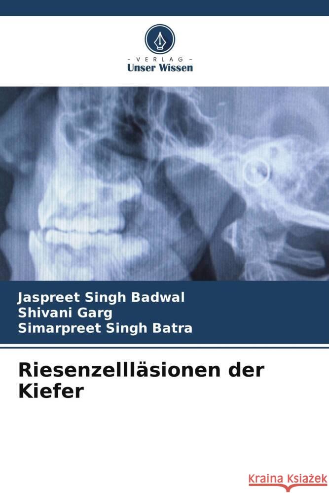 Riesenzellläsionen der Kiefer Badwal, Jaspreet Singh, Garg, Shivani, Batra, Simarpreet Singh 9786208357528