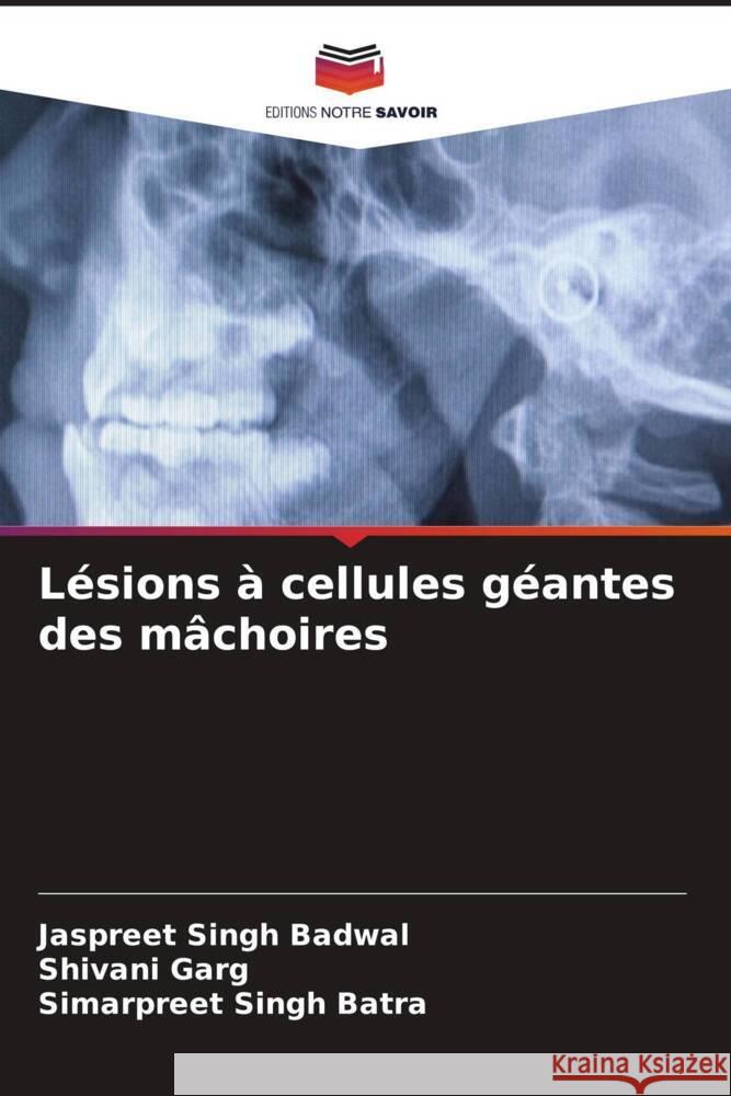 Lésions à cellules géantes des mâchoires Badwal, Jaspreet Singh, Garg, Shivani, Batra, Simarpreet Singh 9786208357535