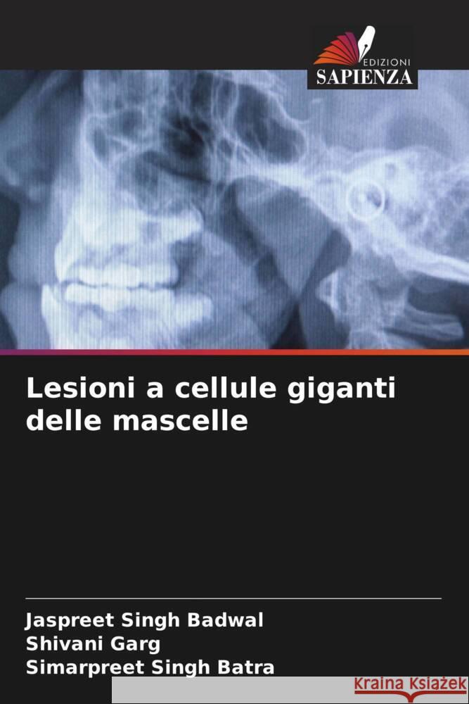 Lesioni a cellule giganti delle mascelle Badwal, Jaspreet Singh, Garg, Shivani, Batra, Simarpreet Singh 9786208357559 Edizioni Sapienza