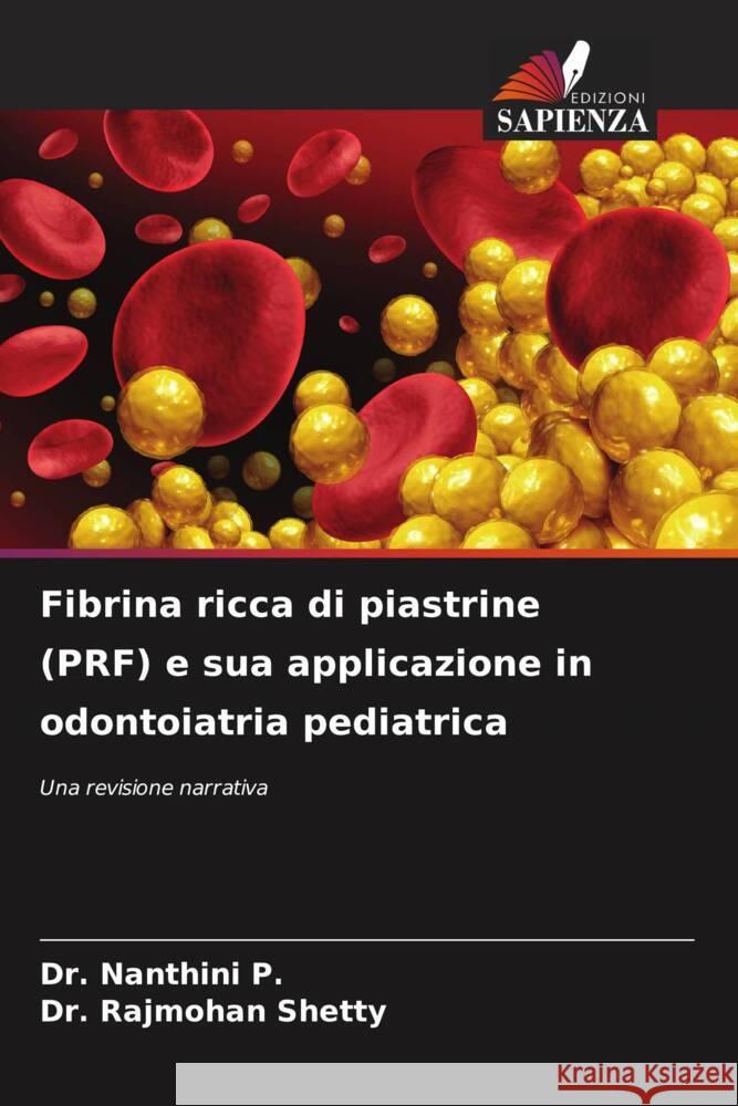 Fibrina ricca di piastrine (PRF) e sua applicazione in odontoiatria pediatrica P., Dr. Nanthini, SHETTY, Dr. RAJMOHAN 9786208367510