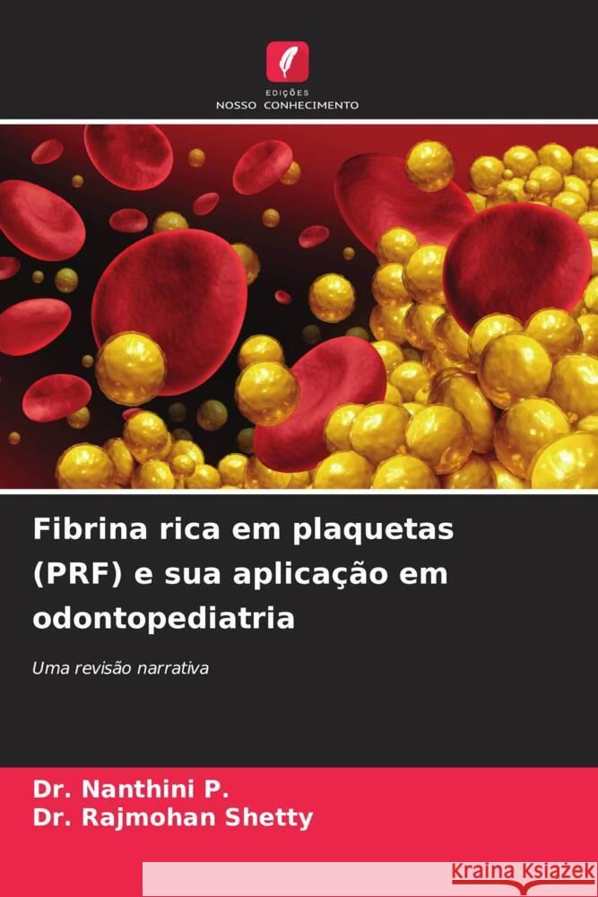 Fibrina rica em plaquetas (PRF) e sua aplicação em odontopediatria P., Dr. Nanthini, SHETTY, Dr. RAJMOHAN 9786208367855