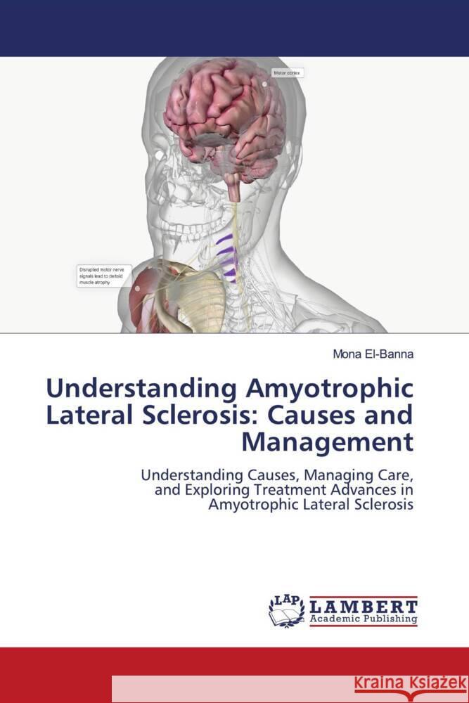 Understanding Amyotrophic Lateral Sclerosis: Causes and Management El-Banna, Mona 9786208420321