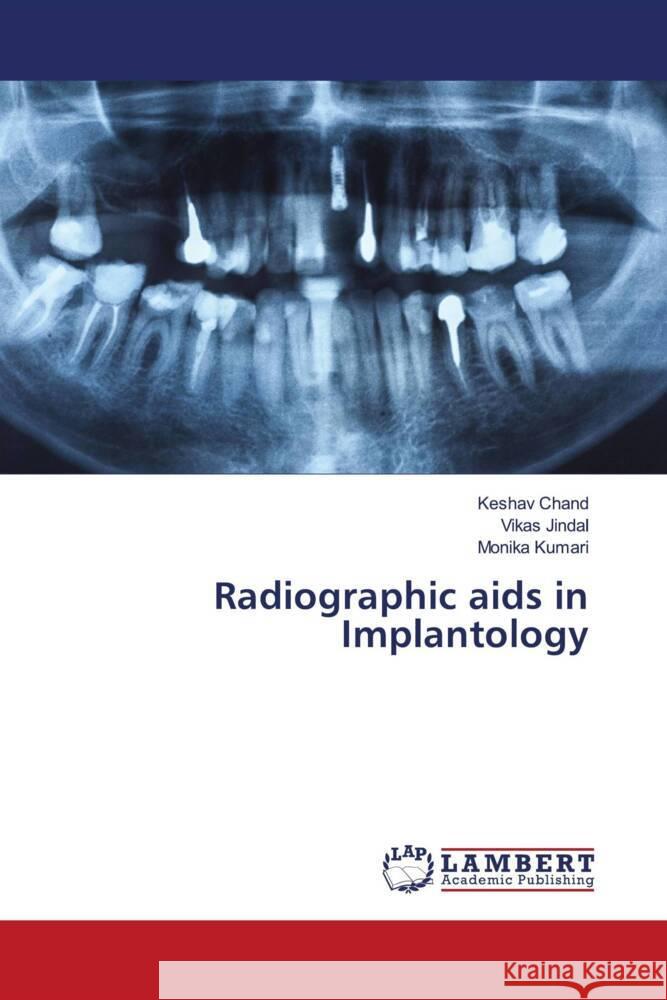 Radiographic aids in Implantology Chand, Keshav, Jindal, Vikas, Kumari, Monika 9786208420611