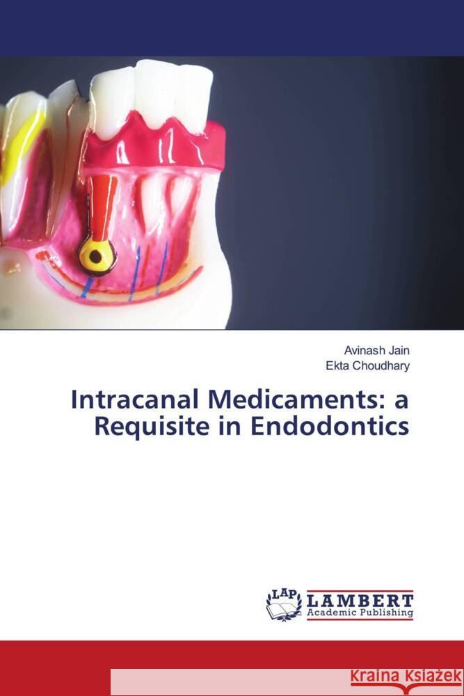 Intracanal Medicaments: a Requisite in Endodontics Jain, Avinash, Choudhary, Ekta 9786208422127