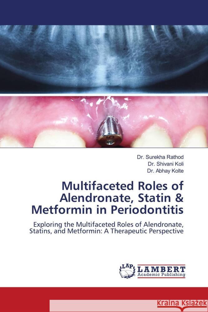 Multifaceted Roles of Alendronate, Statin & Metformin in Periodontitis Surekha Rathod Shivani Koli Abhay Kolte 9786208423582