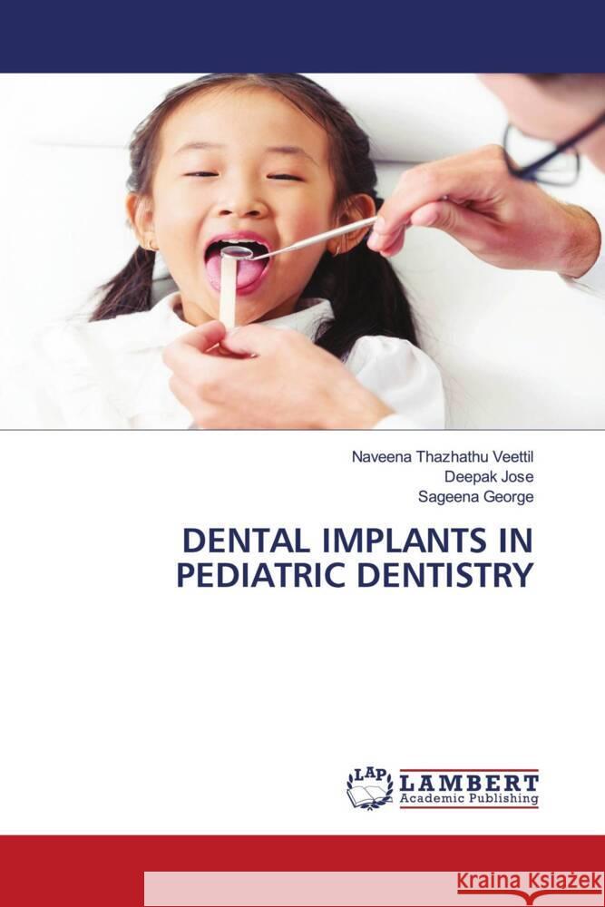 Dental Implants in Pediatric Dentistry Naveena Thazhath Deepak Jose Sageena George 9786208424695