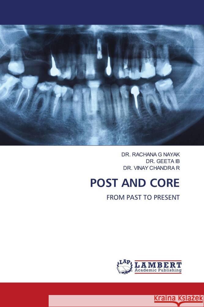 POST AND CORE NAYAK, DR. RACHANA G, IB, DR. GEETA, R, DR. VINAY CHANDRA 9786208428990