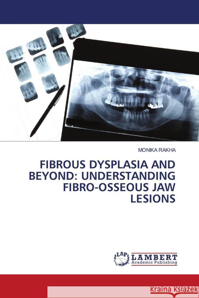 FIBROUS DYSPLASIA AND BEYOND: UNDERSTANDING FIBRO-OSSEOUS JAW LESIONS RAKHA, MONIKA 9786208429638