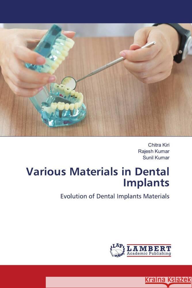 Various Materials in Dental Implants Kiri, Chitra, Kumar, Rajesh, Kumar, Sunil 9786208429836 LAP Lambert Academic Publishing