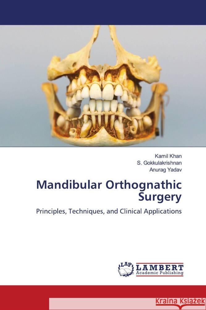 Mandibular Orthognathic Surgery Khan, Kamil, Gokkulakrishnan, S., Yadav, Anurag 9786208432737