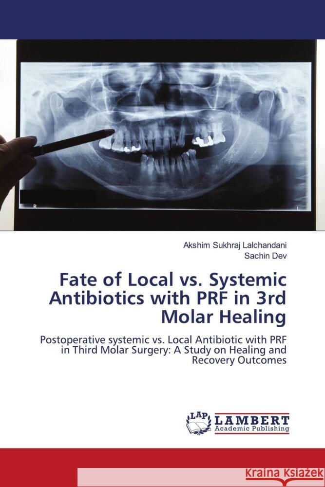 Fate of Local vs. Systemic Antibiotics with PRF in 3rd Molar Healing Lalchandani, Akshim Sukhraj, DEV, SACHIN 9786208435110 LAP Lambert Academic Publishing