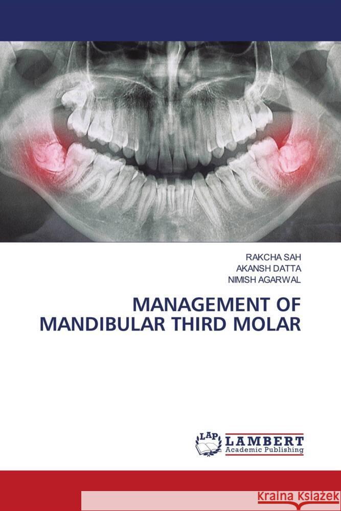 MANAGEMENT OF MANDIBULAR THIRD MOLAR SAH, RAKCHA, DATTA, AKANSH, Agarwal, Nimish 9786208435875 LAP Lambert Academic Publishing