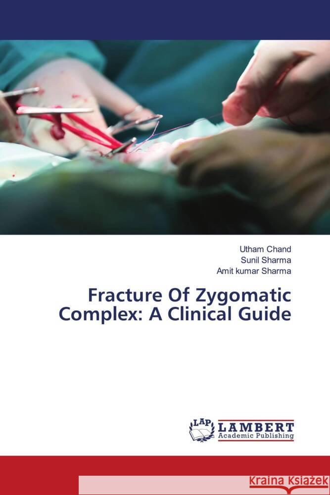Fracture Of Zygomatic Complex: A Clinical Guide Chand, Utham, Sharma, Sunil, Sharma, Amit Kumar 9786208436407